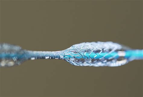  Nitinol: De Wonderstof voor Biomedicale Implantaten en Flexibele Robotica!